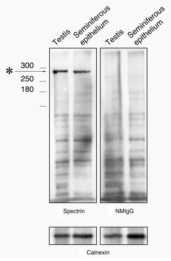 A network of spectrin and plectin surrounds the actin cuffs of apical tubulobulbar complexes in the rat.