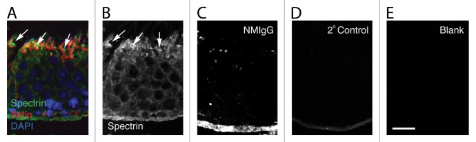 A network of spectrin and plectin surrounds the actin cuffs of apical tubulobulbar complexes in the rat.