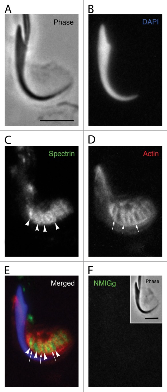 A network of spectrin and plectin surrounds the actin cuffs of apical tubulobulbar complexes in the rat.