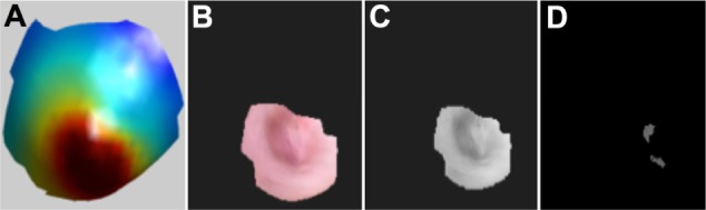 Automated Identification of Fiducial Points on 3D Torso Images.