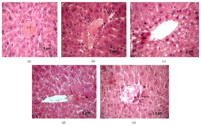 In Vivo Effect of Arsenic Trioxide on Keap1-p62-Nrf2 Signaling Pathway in Mouse Liver: Expression of Antioxidant Responsive Element-Driven Genes Related to Glutathione Metabolism.