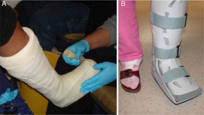 Conservative and surgical treatment of the chronic Charcot foot and ankle.