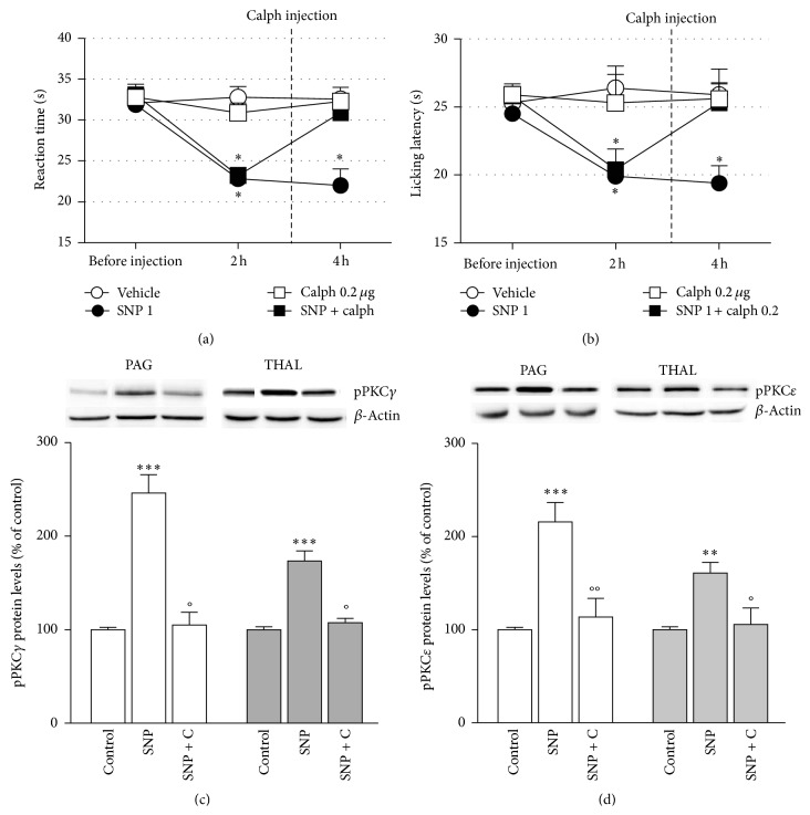 PKC-Dependent Signaling Pathways within PAG and Thalamus Contribute to the Nitric Oxide-Induced Nociceptive Behavior.