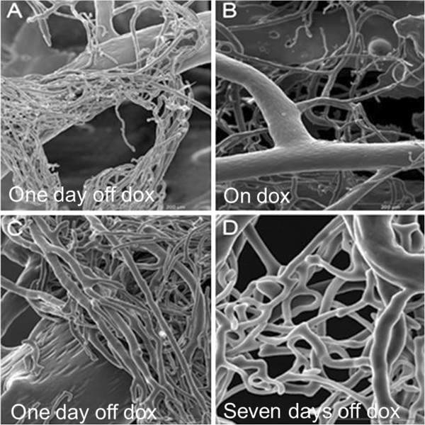 Cardiac angiogenesis directed by stable Hypoxia Inducible Factor-1.