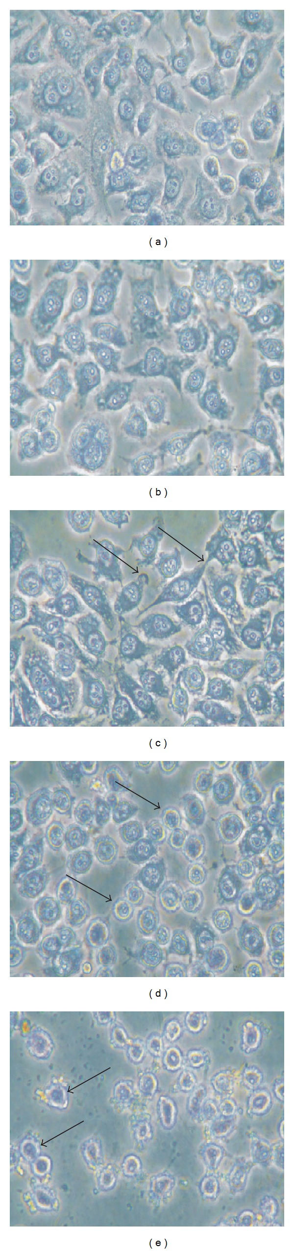 Nanosized zinc oxide induces toxicity in human lung cells.