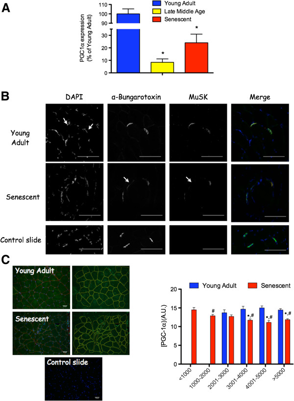 Role of peroxisome proliferator-activated receptor gamma coactivator 1-alpha (PGC-1α) in denervation-induced atrophy in aged muscle: facts and hypotheses.