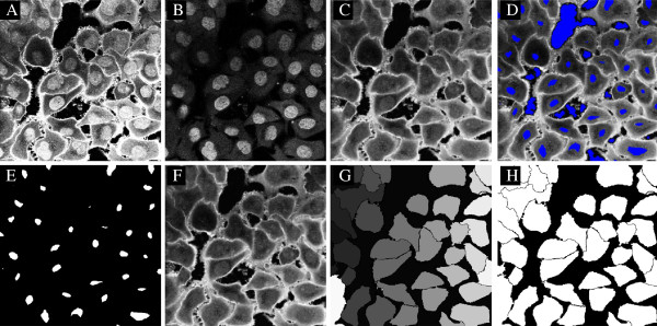 CellSegm - a MATLAB toolbox for high-throughput 3D cell segmentation.