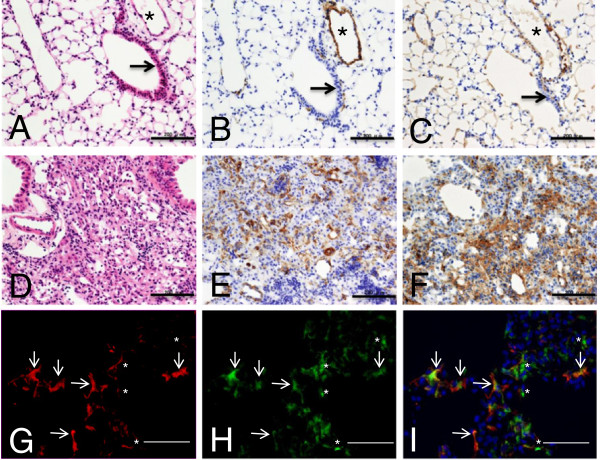 Direct isolation of myofibroblasts and fibroblasts from bleomycin-injured lungs reveals their functional similarities and differences.