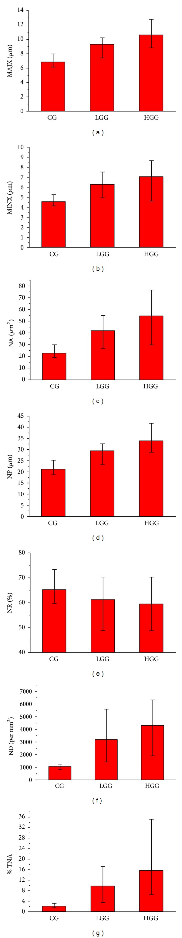 Utility of nuclear morphometry in predicting grades of diffusely infiltrating gliomas.
