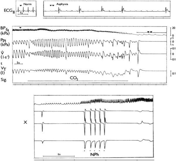 Resuscitation and auto resuscitation by airway reflexes in animals.