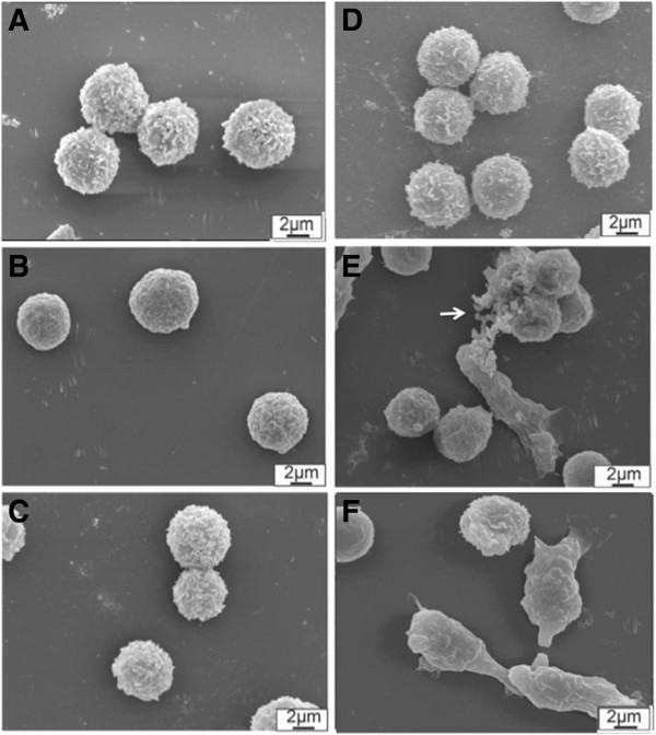 Kinetic effects of TiO2 fine particles and nanoparticles aggregates on the nanomechanical properties of human neutrophils assessed by force spectroscopy.