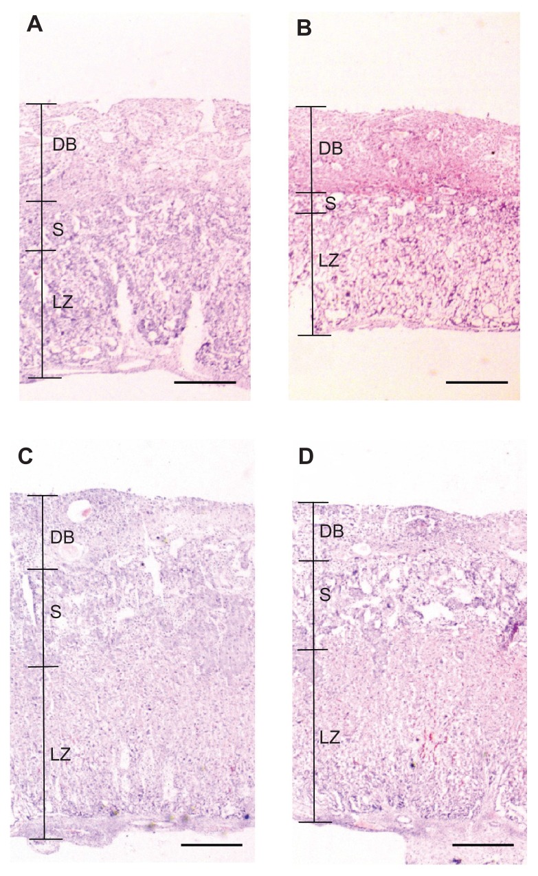 L-tryptophan metabolism in pregnant mice fed a high L-tryptophan diet and the effect on maternal, placental, and fetal growth.