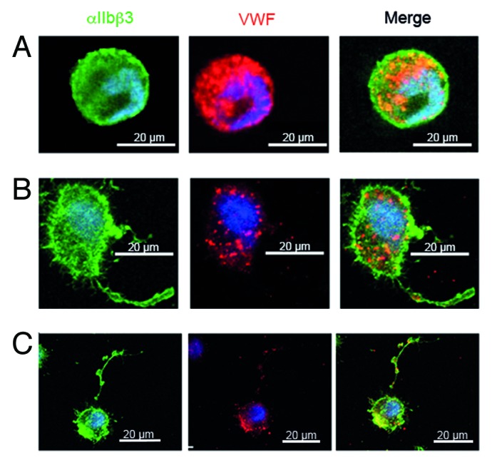 The Nbeal2(-/-) mouse as a model for the gray platelet syndrome.