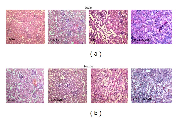 Inhibition of Nitric Oxide Synthase by L-NAME Promotes Cisplatin-Induced Nephrotoxicity in Male Rats.