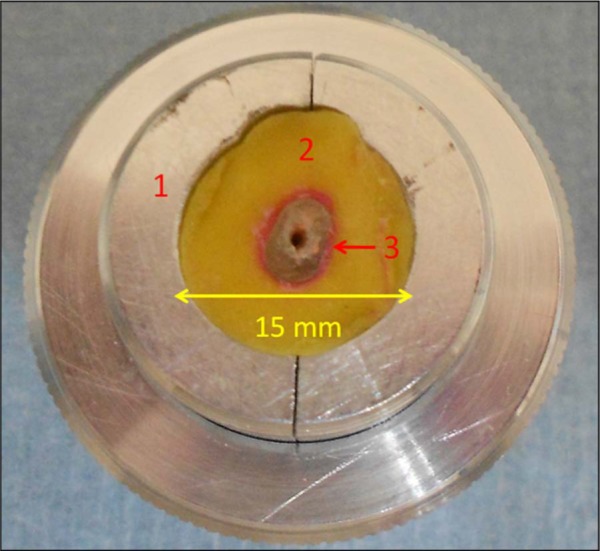 Device and materials for in vitro evaluation of forces developed to teeth and periodontal structures during dental practices.