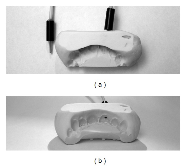 Laser Doppler Blood-Flow Signals from Human Teeth during an Alignment and Leveling Movement Using a Superelastic Archwire.