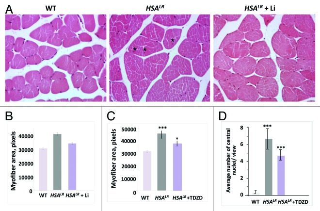 GSK3β is a new therapeutic target for myotonic dystrophy type 1.