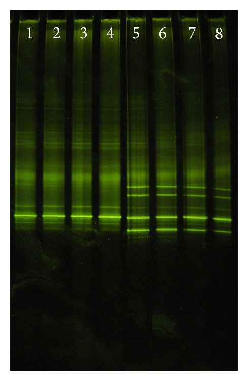16S rRNA PCR-Denaturing Gradient Gel Electrophoresis of Oral Lactobacillus casei Group and Their Phenotypic Appearances.