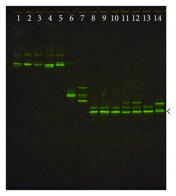 16S rRNA PCR-Denaturing Gradient Gel Electrophoresis of Oral Lactobacillus casei Group and Their Phenotypic Appearances.