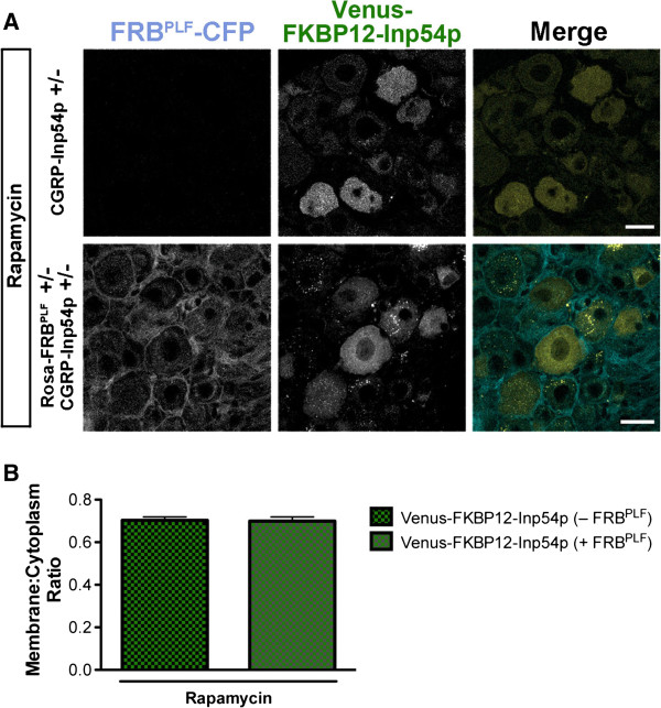 Biological constraints limit the use of rapamycin-inducible FKBP12-Inp54p for depleting PIP2 in dorsal root ganglia neurons.