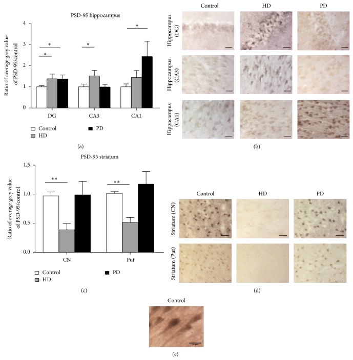 Differential Changes in Postsynaptic Density Proteins in Postmortem Huntington's Disease and Parkinson's Disease Human Brains.