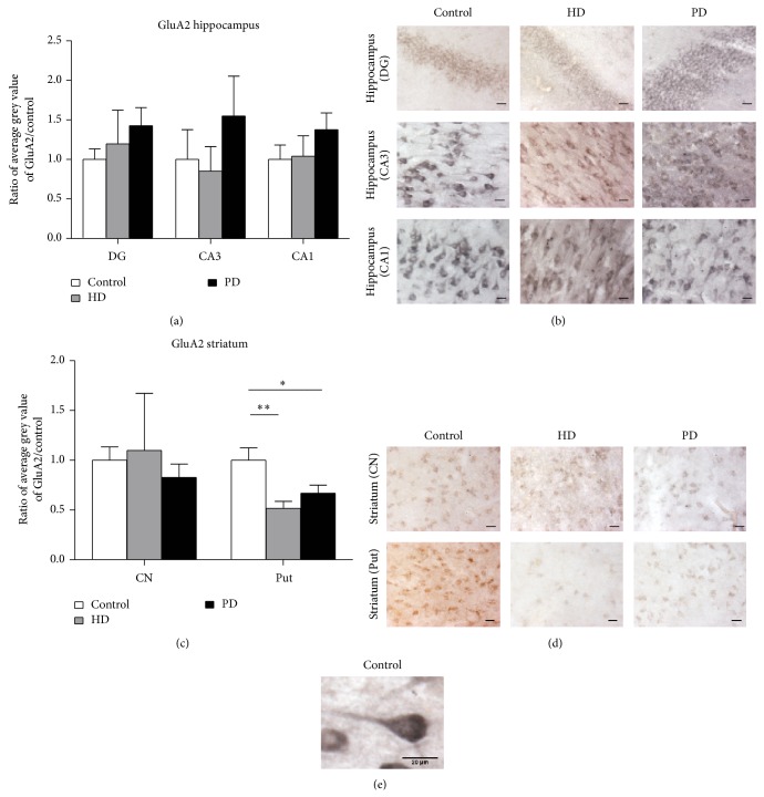 Differential Changes in Postsynaptic Density Proteins in Postmortem Huntington's Disease and Parkinson's Disease Human Brains.