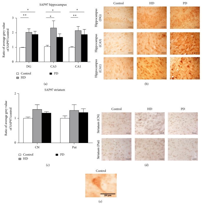 Differential Changes in Postsynaptic Density Proteins in Postmortem Huntington's Disease and Parkinson's Disease Human Brains.