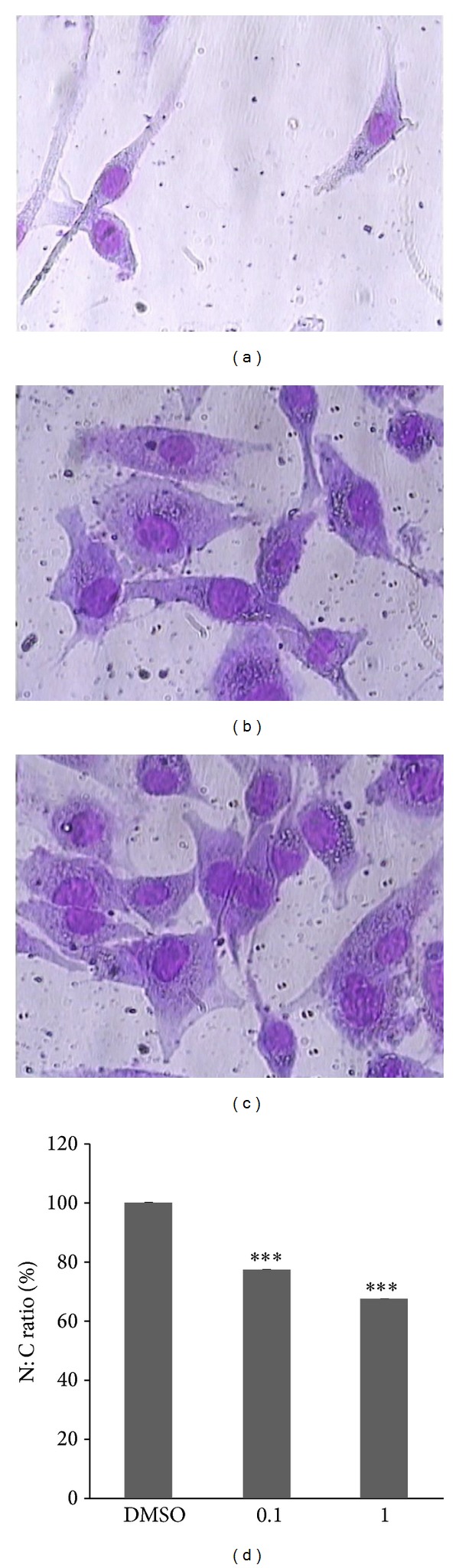 The Beneficial Effects of Valproic Acid in Thyroid Cancer Are Mediated through Promoting Redifferentiation and Reducing Stemness Level: An In Vitro Study.