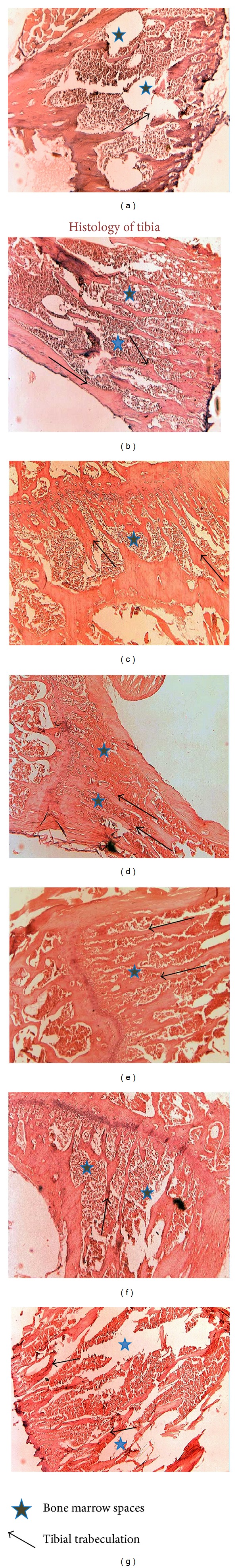 Methanol Extract of Euchelus asper Prevents Bone Resorption in Ovariectomised Mice Model.