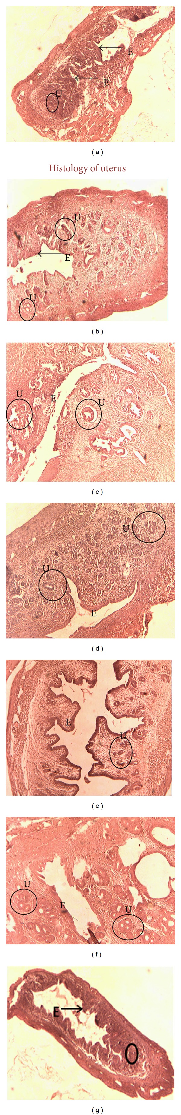 Methanol Extract of Euchelus asper Prevents Bone Resorption in Ovariectomised Mice Model.