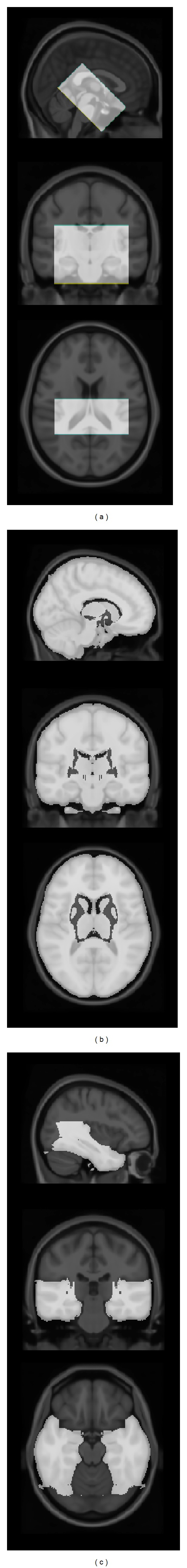 High-Dimensional Medial Lobe Morphometry: An Automated MRI Biomarker for the New AD Diagnostic Criteria.