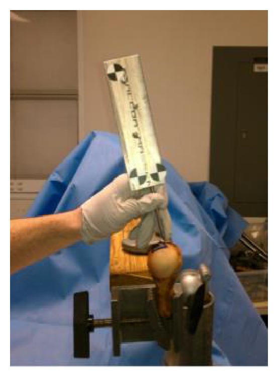 Mapping the articular contact area of the long head of the biceps tendon on the humeral head.