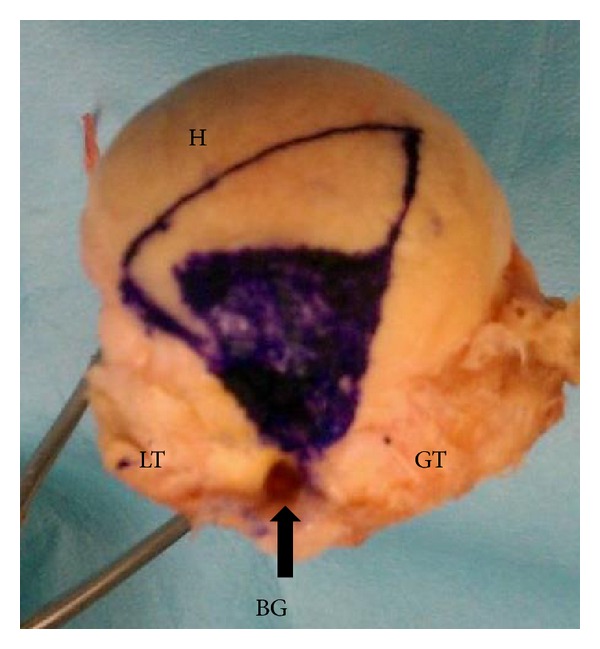 Mapping the articular contact area of the long head of the biceps tendon on the humeral head.