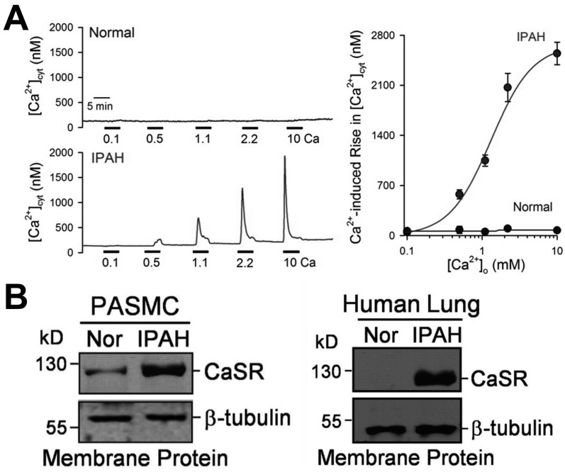 Pathological function of Ca2+-sensing receptor in pulmonary arterial hypertension.