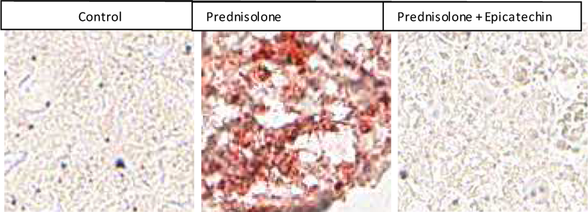 Epicatechin Protects against Corticosteroid Induced Hepatic Steatosis.