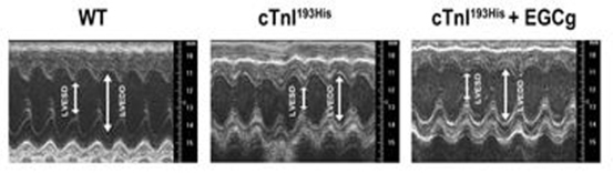 Troponin Mutation Caused Diastolic Dysfunction and Experimental Treatment in Transgenic Mice with Cardiomyopathy.