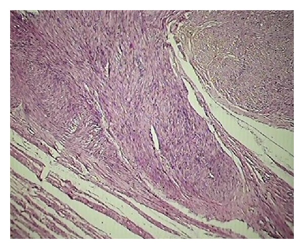 Histopathological audit of 373 nononcological hysterectomies in a teaching hospital.