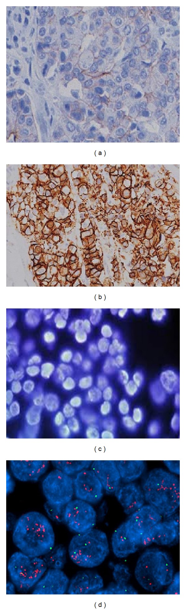 Human Epidermal Growth Factor Receptor 2 (HER2) in Cancers: Overexpression and Therapeutic Implications.