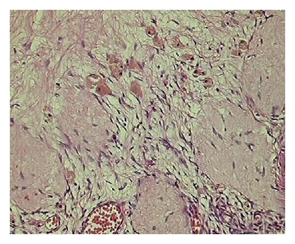 Histopathological audit of 373 nononcological hysterectomies in a teaching hospital.