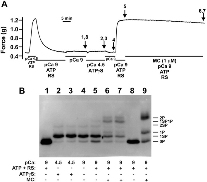 Involvement of myosin regulatory light chain diphosphorylation in sustained vasoconstriction under pathophysiological conditions.