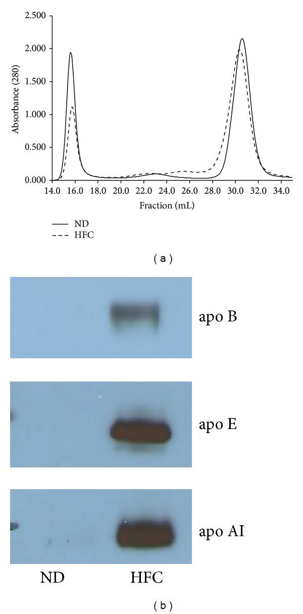 The Influence of an Obesogenic Diet on Oxysterol Metabolism in C57BL/6J Mice.