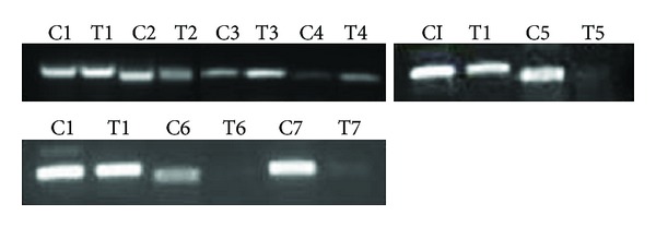 The effect of alendronate on proteome of hepatocellular carcinoma cell lines.