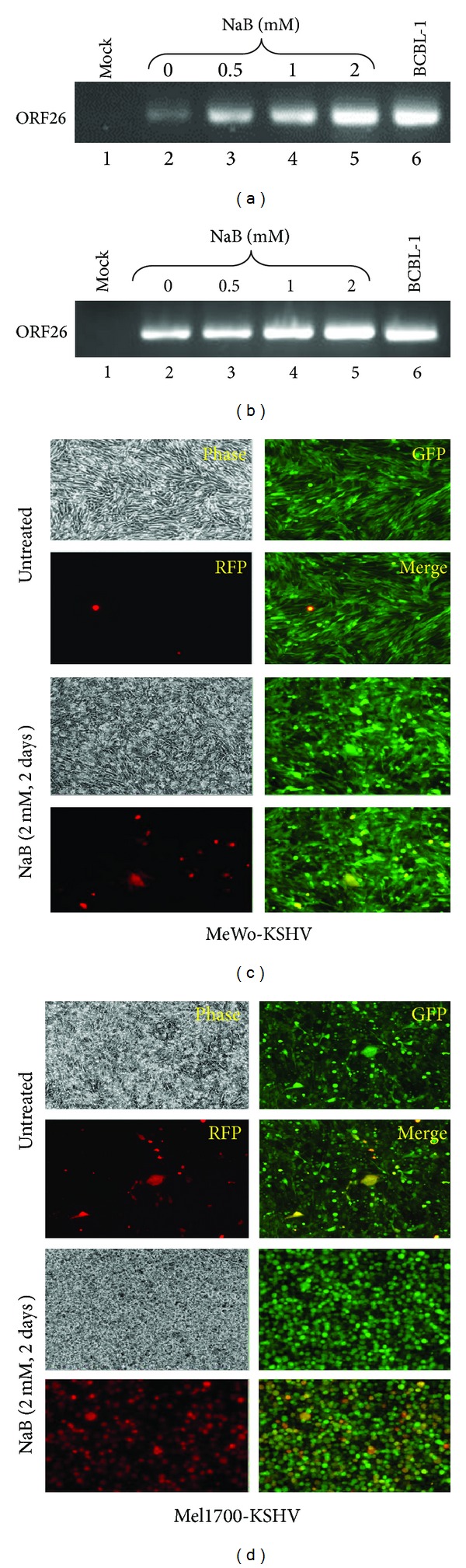 Kaposi's Sarcoma-Associated Herpesvirus Subversion of the Anti-Inflammatory Response in Human Skin Cells Reveals Correlates of Latency and Disease Pathogenesis.