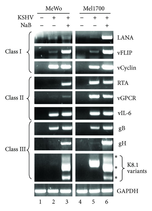 Kaposi's Sarcoma-Associated Herpesvirus Subversion of the Anti-Inflammatory Response in Human Skin Cells Reveals Correlates of Latency and Disease Pathogenesis.