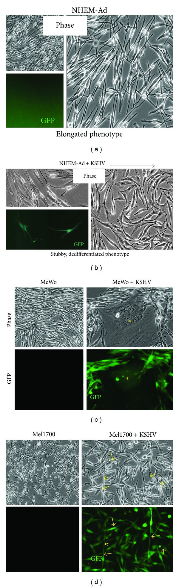 Kaposi's Sarcoma-Associated Herpesvirus Subversion of the Anti-Inflammatory Response in Human Skin Cells Reveals Correlates of Latency and Disease Pathogenesis.