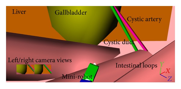 In silico investigation of a surgical interface for remote control of modular miniature robots in minimally invasive surgery.