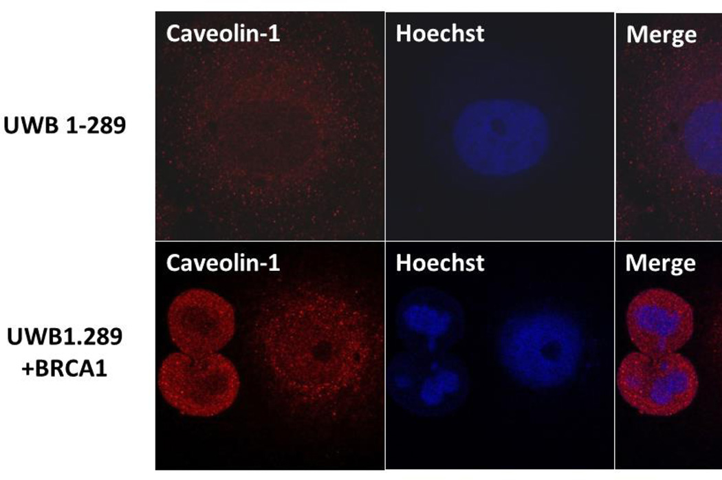 A Novel Pathway that Links Caveolin-1 Down-Regulation to BRCA1 Dysfunction in Serous Epithelial Ovarian Cancer Cells.