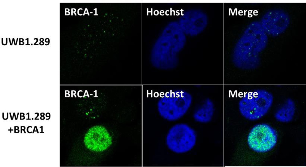 A Novel Pathway that Links Caveolin-1 Down-Regulation to BRCA1 Dysfunction in Serous Epithelial Ovarian Cancer Cells.