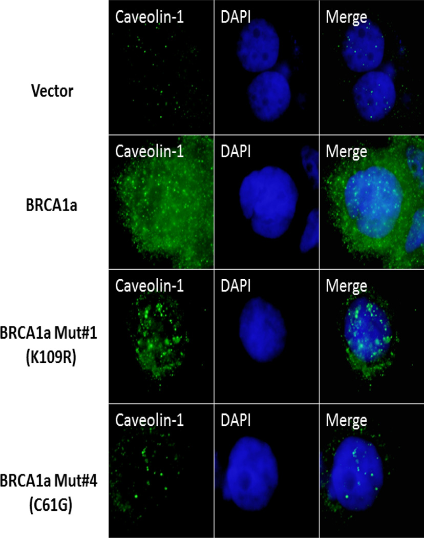 A Novel Pathway that Links Caveolin-1 Down-Regulation to BRCA1 Dysfunction in Serous Epithelial Ovarian Cancer Cells.