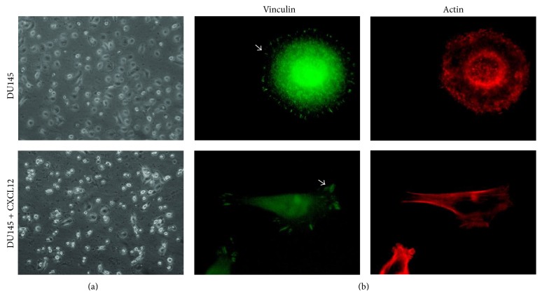 CXCL12 Modulates Prostate Cancer Cell Adhesion by Altering the Levels or Activities of β1-Containing Integrins.